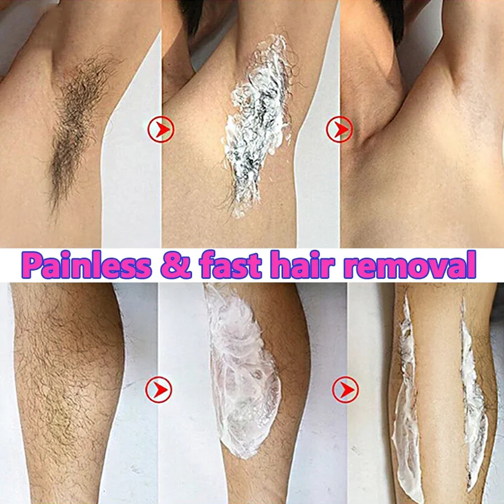 Fast Hair Removal Cream Painless Hair Growth I